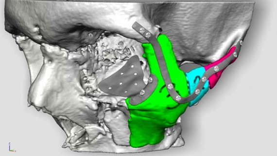 Trois nouvelles pièces seront produites par l'imprimante 3D