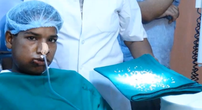 Un jeune indien avec 260 dents, les médecins lui retirent 232!