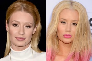 Iggy Azalea : Nouveaux seins, un nouveau nez et un nouveau menton !