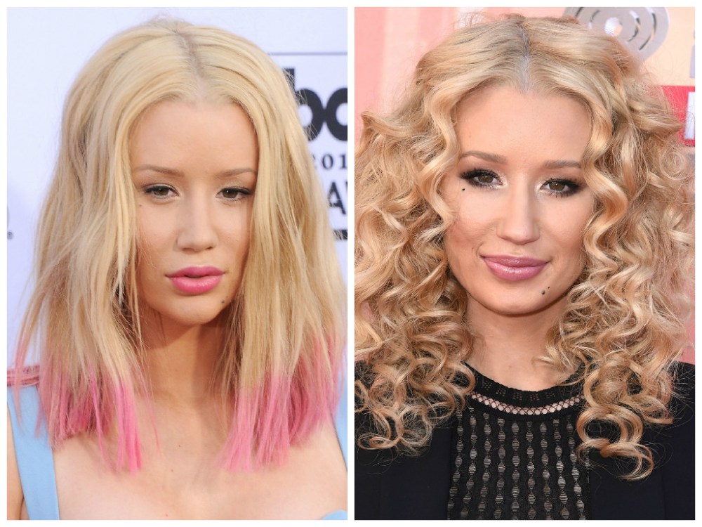 Iggy Azalea : Nouveaux seins, un nouveau nez et un nouveau menton !